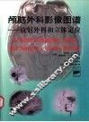 颅脑外科影像图谱  放射外科和立体定位
