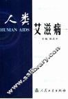 人类艾滋病