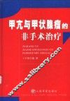 甲亢与甲状腺瘤的非手术治疗