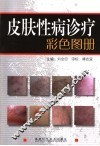 皮肤性病诊疗彩色图册