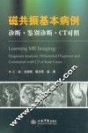 磁共振基本病例  诊断 鉴别诊断 CT对照