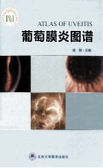 葡萄膜炎图谱【杨柳主编】-PDF电子版