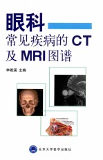眼科常见疾病的CT及MRI图谱【李若溪主；齐飞，杨靖，张绍丹副主编；崔兵杰，姜秀，李若溪，齐飞等编委】-PDF电子版