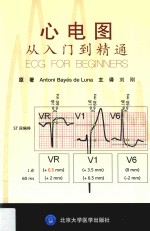 心电图从入门到精通【Antoni Bayes De Luna原著】-PDF电子版