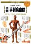 图解手到病自除  全彩图解典藏版