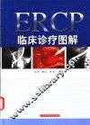 ERCP临床诊疗图解