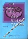 腹部多层螺旋CT图谱