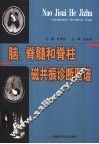 脑、脊髓和脊柱磁共振诊断图谱