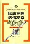 临床护理病情观察