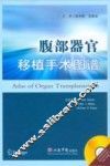 腹部器官移植手术图谱