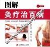 图解灸疗治百病