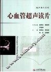 心血管超声读片