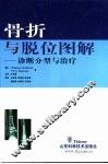 骨折与脱位图解  诊断分型与治疗