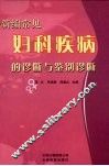 新编常见妇科疾病的诊断与鉴别诊断