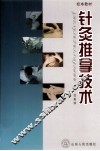 针灸推拿技术  校本教材