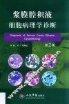 浆膜腔积液细胞病理学诊断