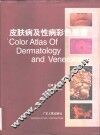 皮肤病及性病彩色图谱