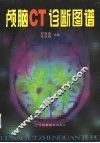 颅脑CT诊断图谱