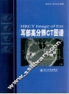 耳部高分辨力CT图谱