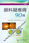 眼科疑难病90例