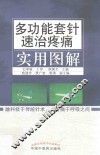 多功能套针速治疼痛实用图解