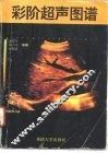 彩阶超声图谱