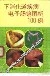 下消化道疾病电子肠镜图析100例
