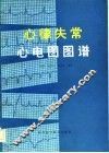 心律失常心电图图谱