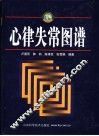 心律失常图谱