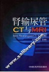 肾输尿管CT与MRI