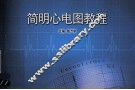 简明心电图教程