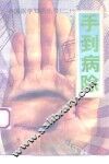 手到病除