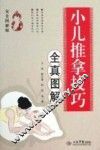 小儿推拿技巧全真图解