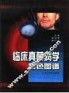 临床真菌病学彩色图谱