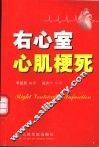 右心室心肌梗死