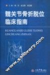 髋关节骨折脱位临床指南