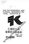 乙型肝炎的发病机理及临床