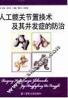 人工髋关节置换术及其并发症的防治