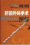 简明肝胆外科手术图解