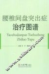 腰椎间盘突出症治疗图谱