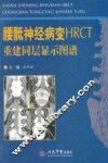 腰骶神经病变HRCT  重建同层显示图谱