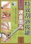 特效刮痧拔罐速查图典
