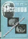 腹部CT诊断图谱