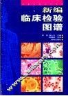 新编临床检验图谱