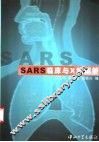 SARS临床及X线图析