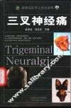 三叉神经痛