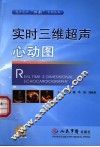 实时三维超声心动图