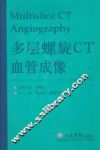 多层螺旋CT血管成像