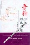 手针疗法临床应用