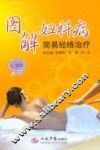 图解妇科病简易经络治疗